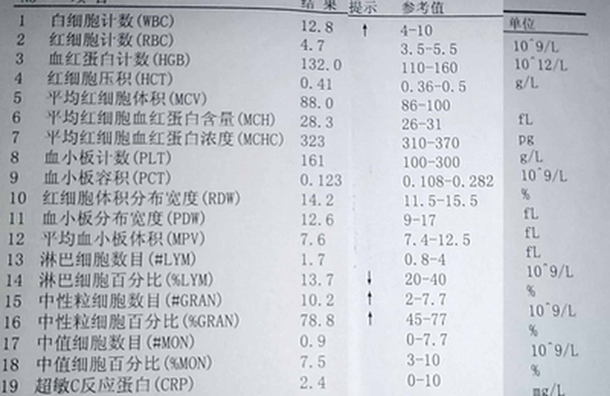 肝功能常规检查