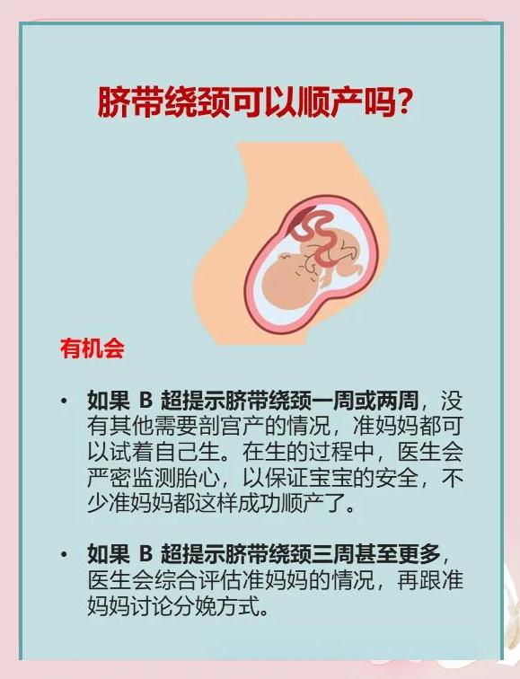 脐带绕颈两周能顺产吗