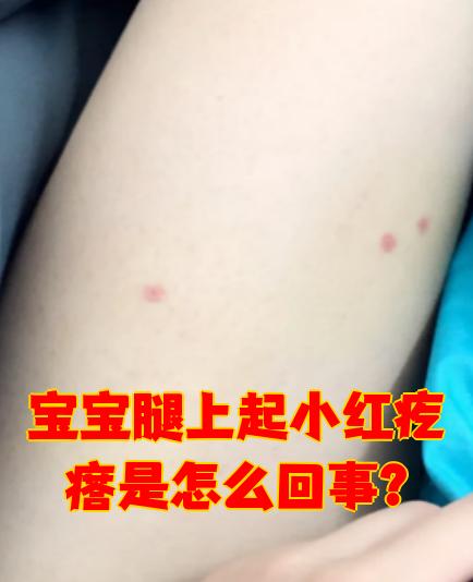 腿上有小疙瘩怎么回事