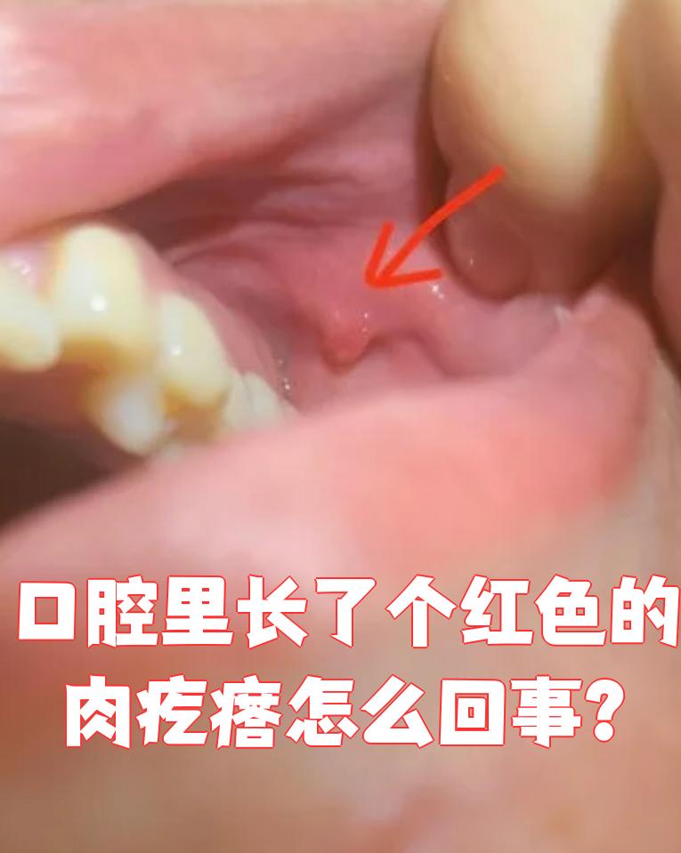 斐誉