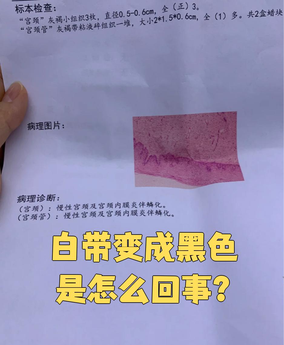 白带带血是怎么回事