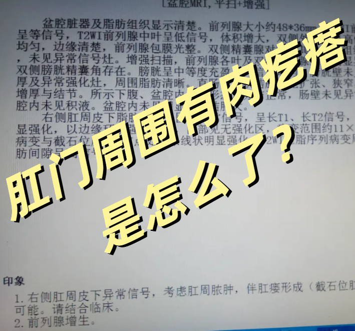 卢兰英