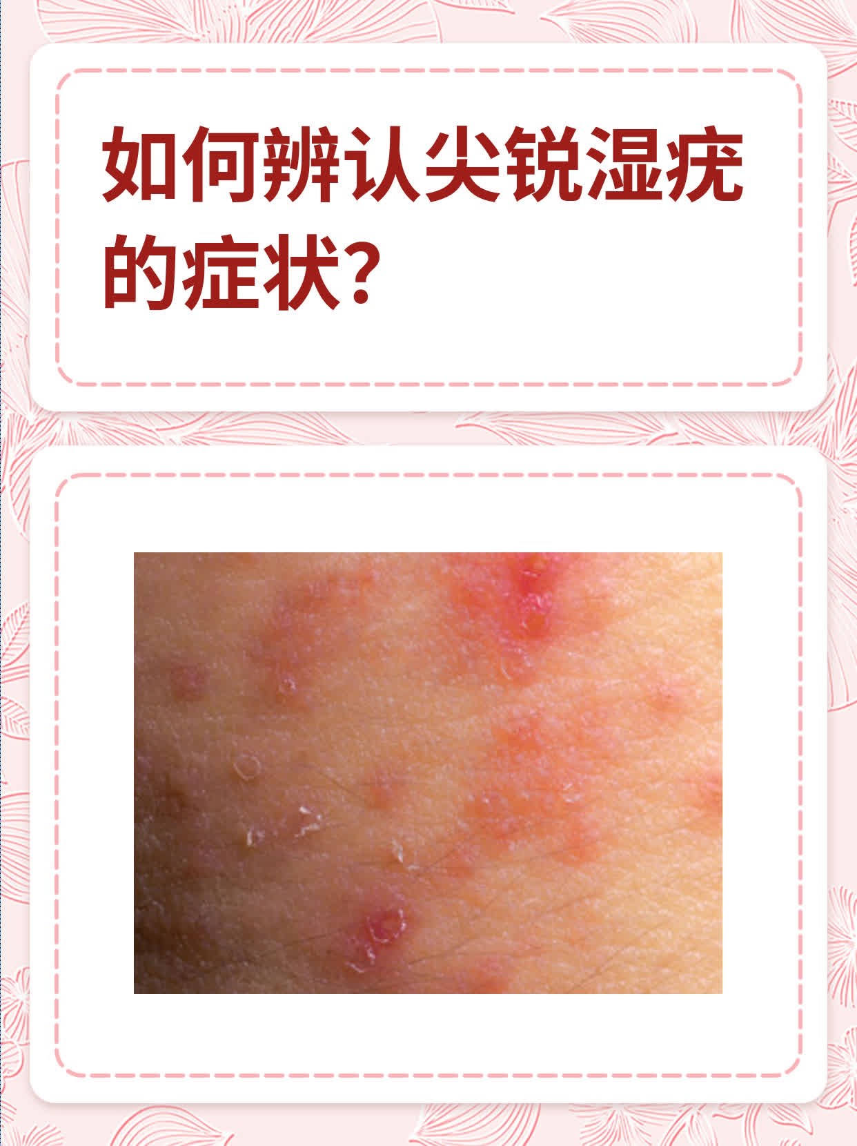 楚城
