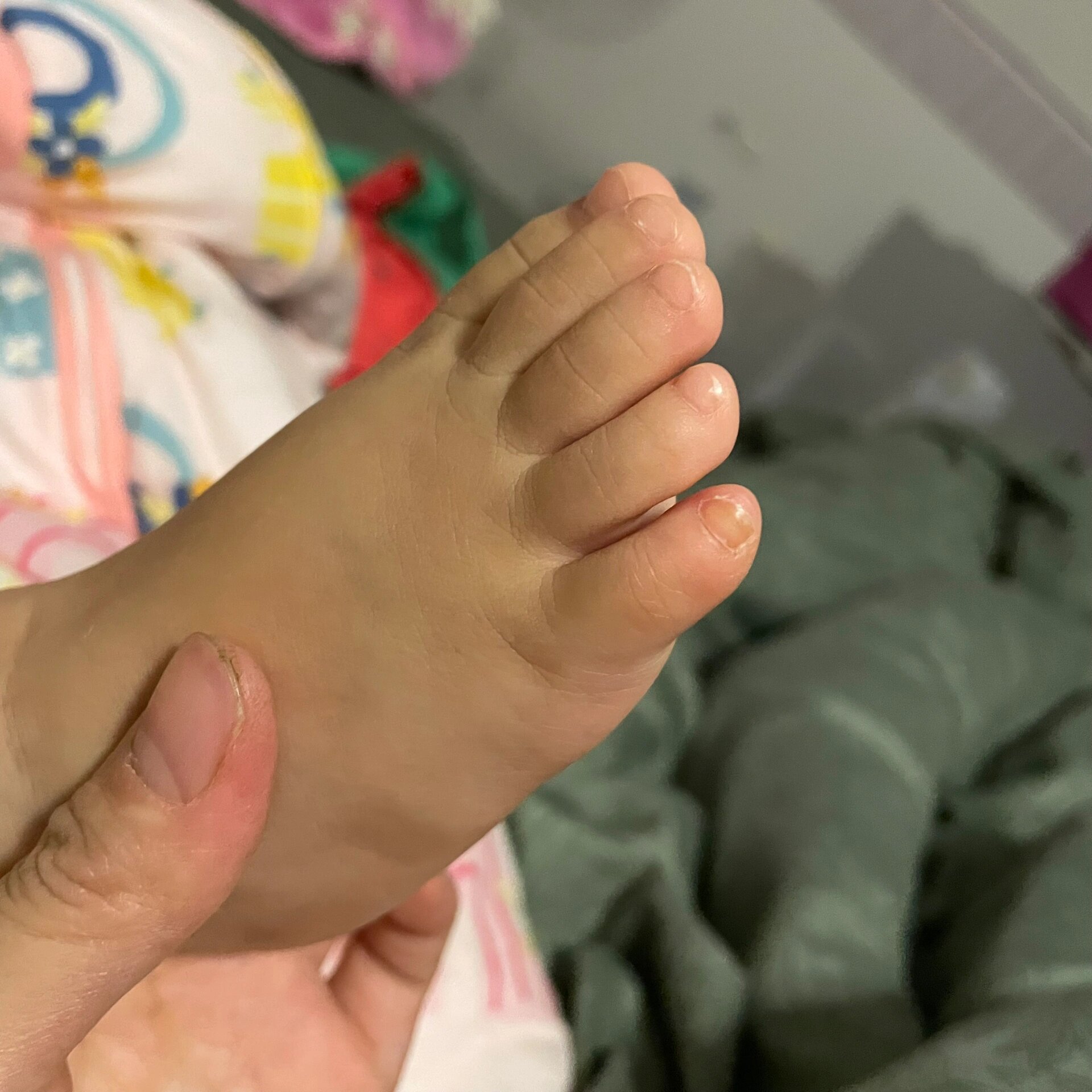 脚趾甲发黄,