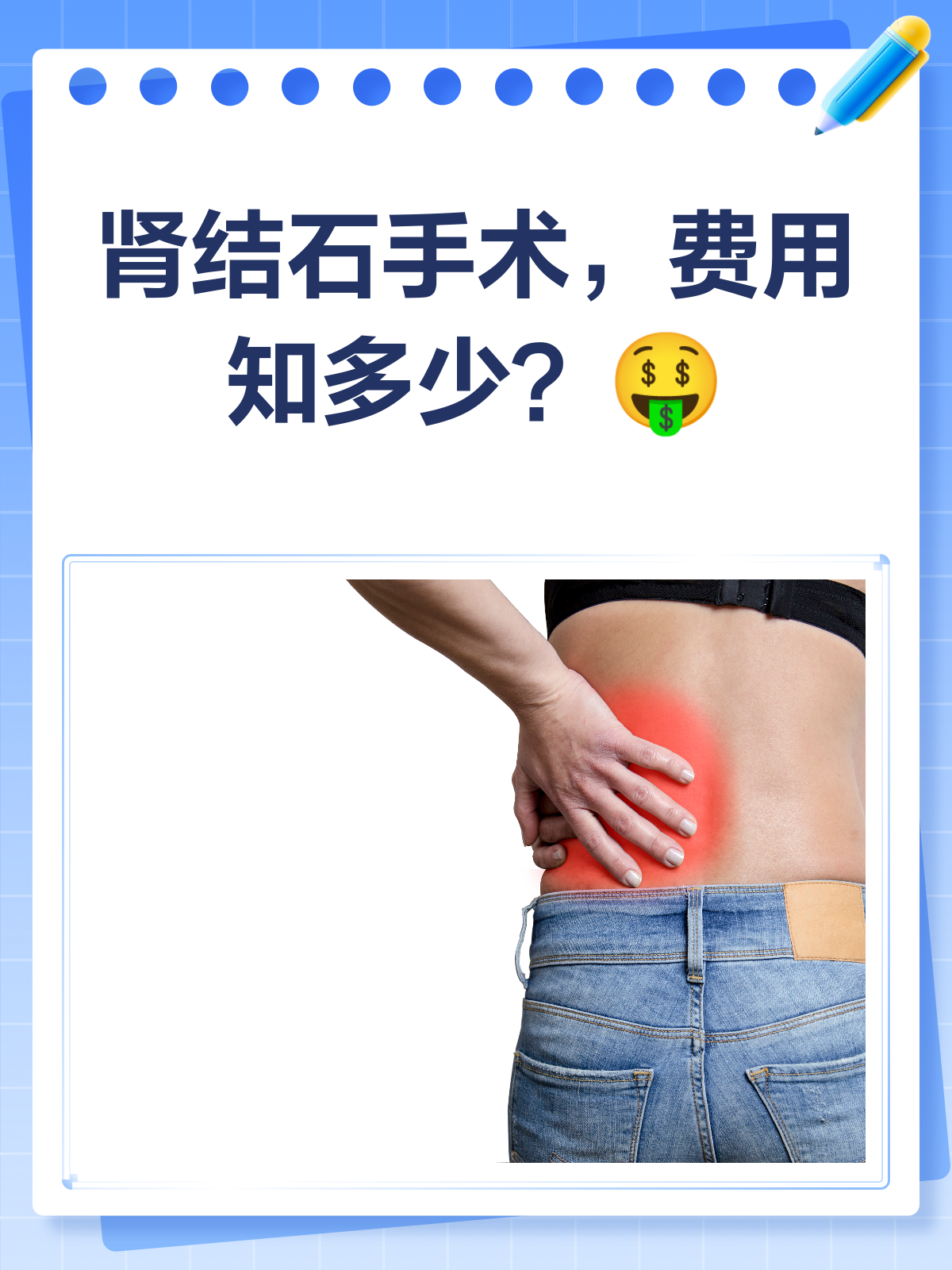 肾结石10mm需要手术吗