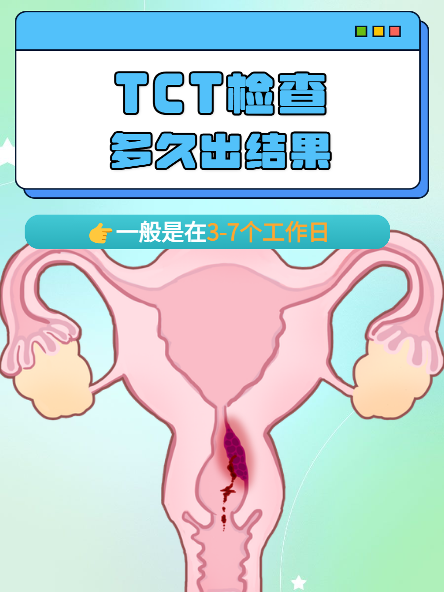 TCT怎么检查