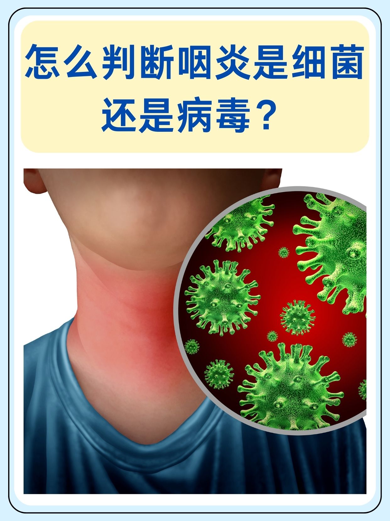 咽炎与咽喉炎的.区别