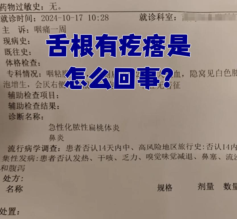 舌根后部淋巴增生会癌变吗?