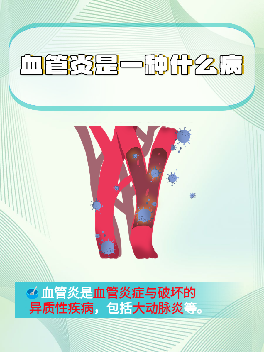 血管炎严重吗