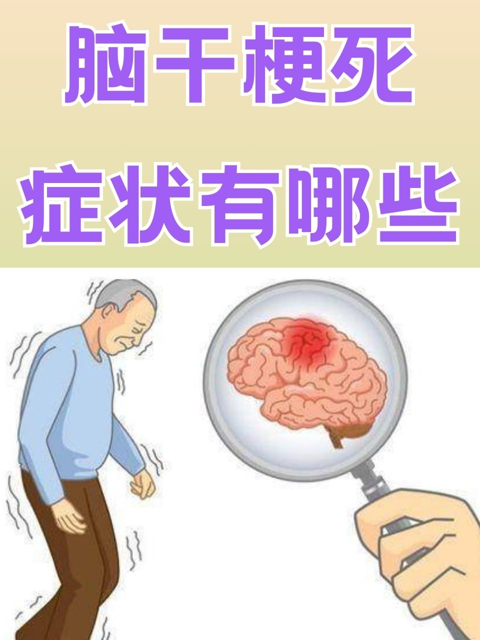 脑梗前兆有哪些