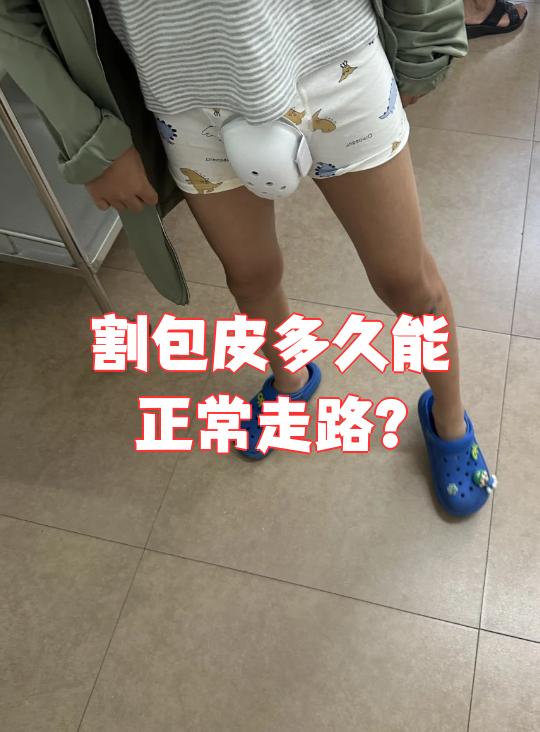 割包皮多长时间