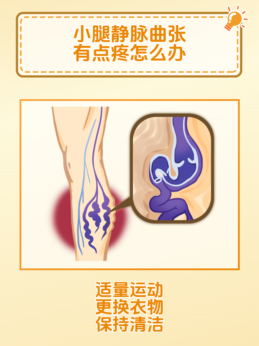 静脉曲张的最好的治疗方法