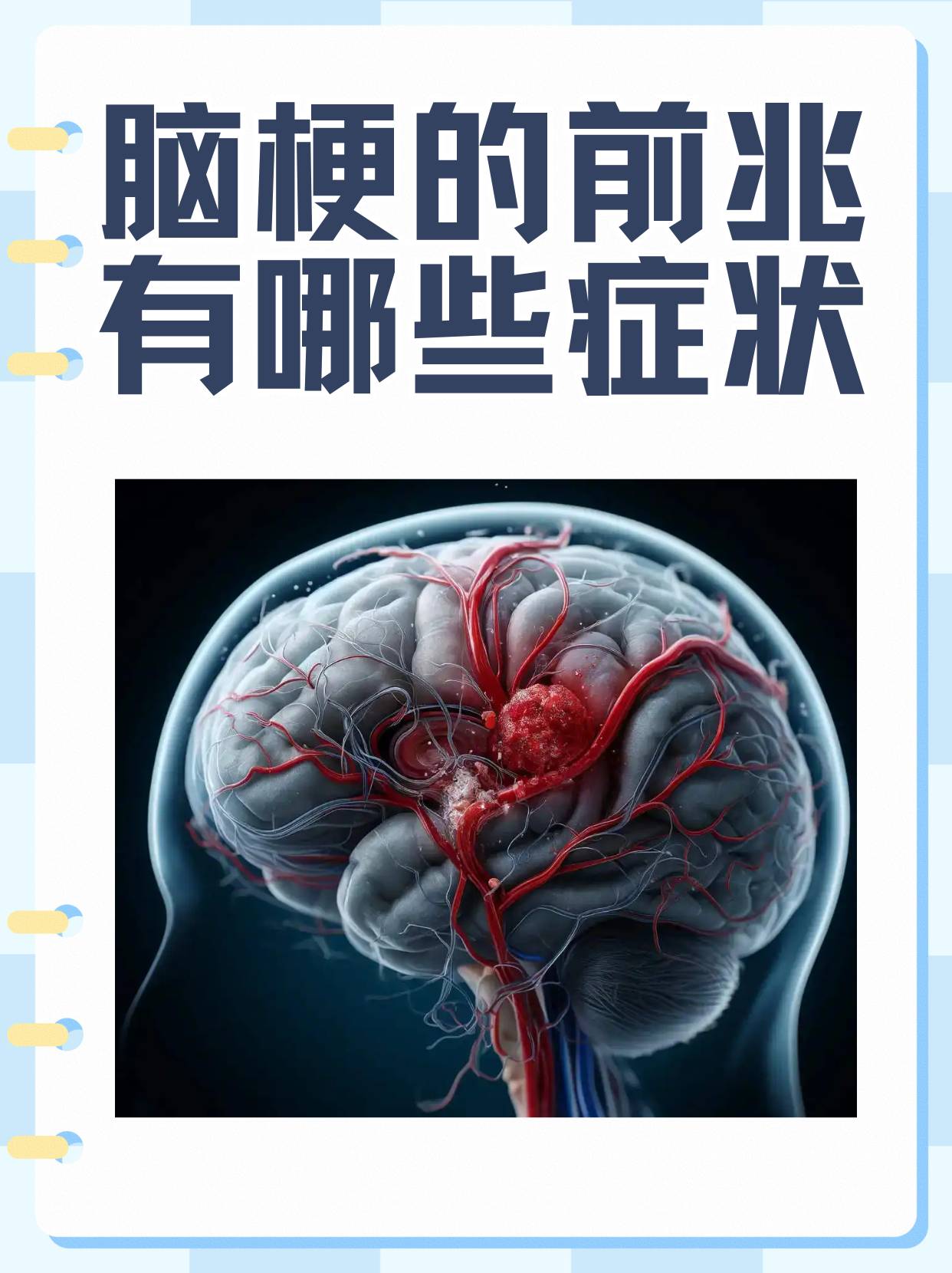 脑梗塞的发病原因是什么?