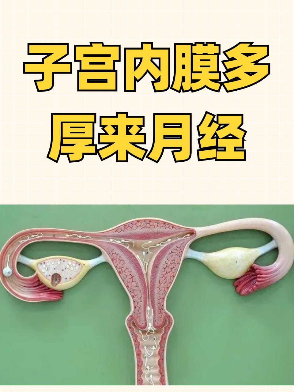 子宫内膜增厚是什么原因引起的?