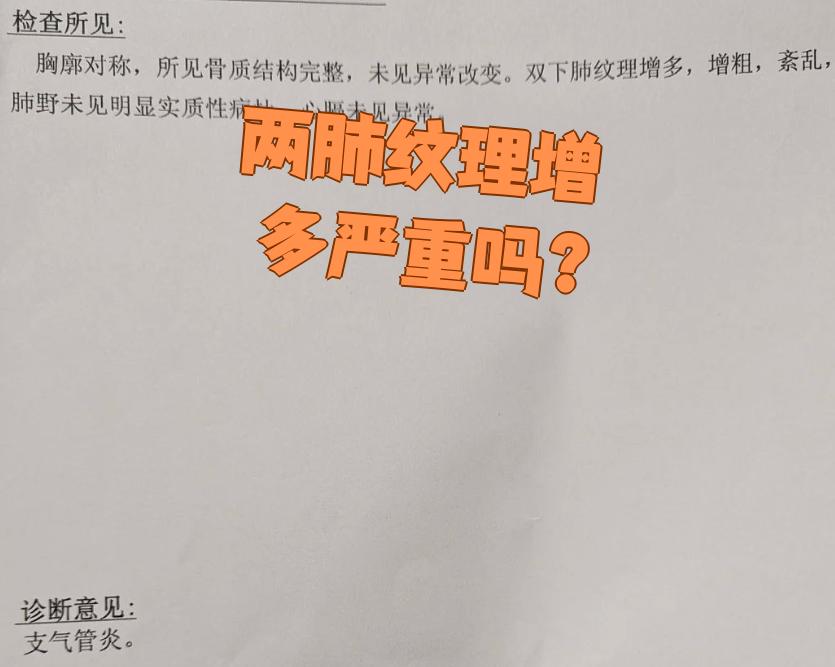 嘉依秋