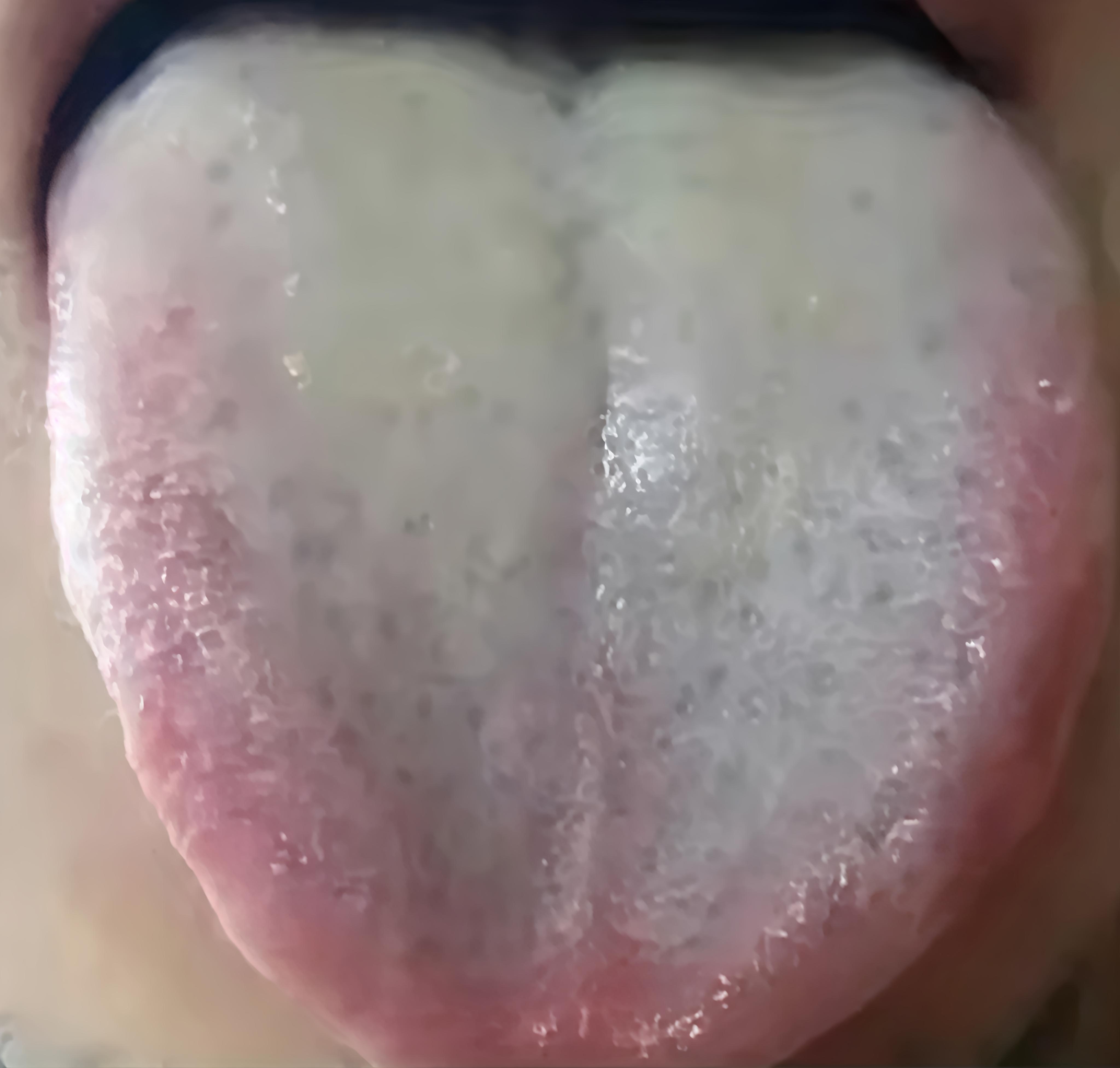 舌苔..........