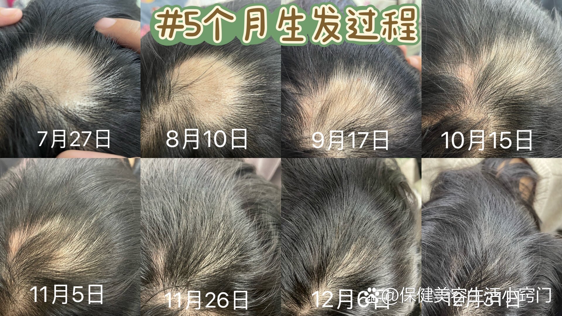 掉头发还会长出来吗