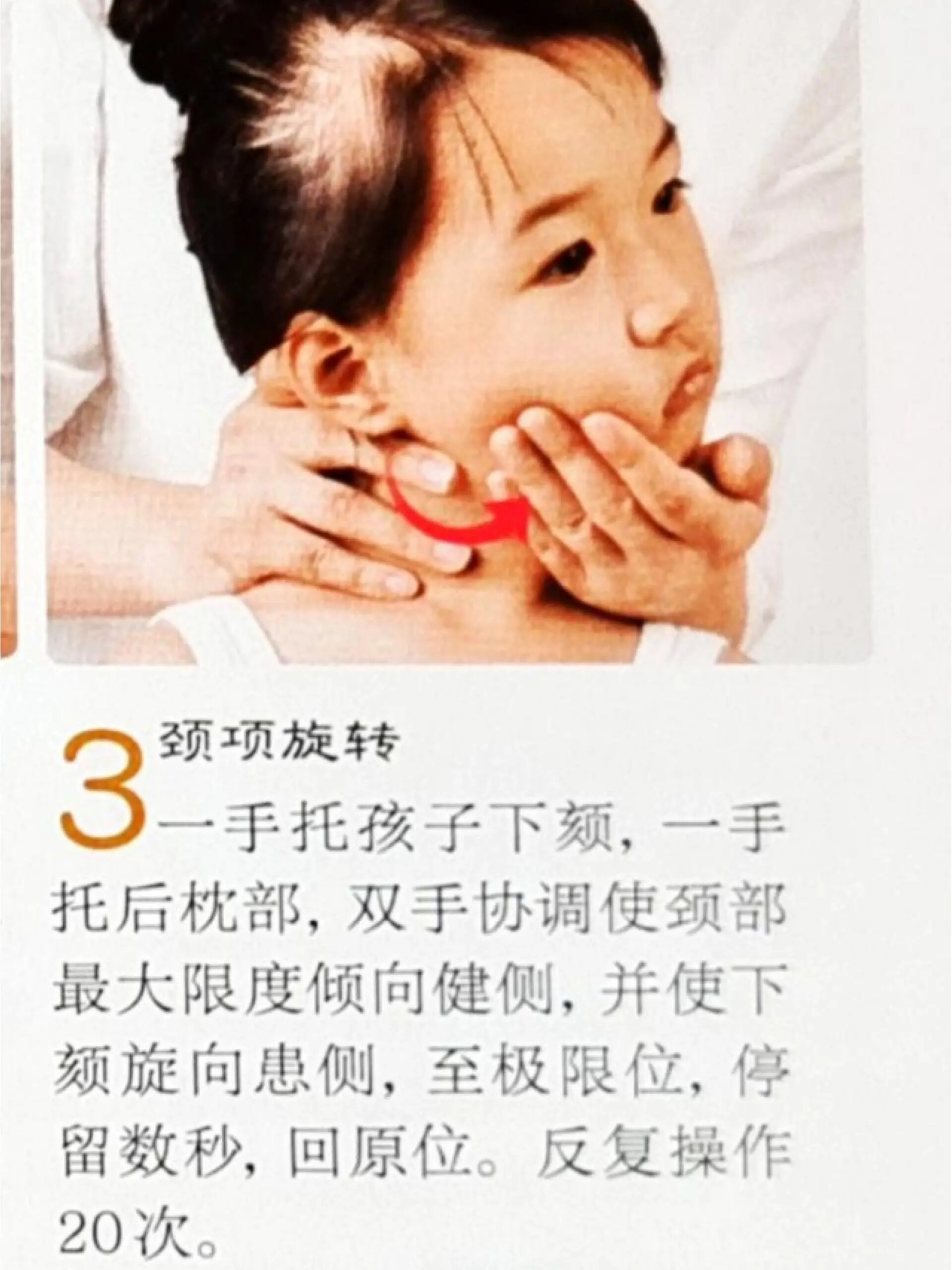 宝宝斜颈怎么治疗?