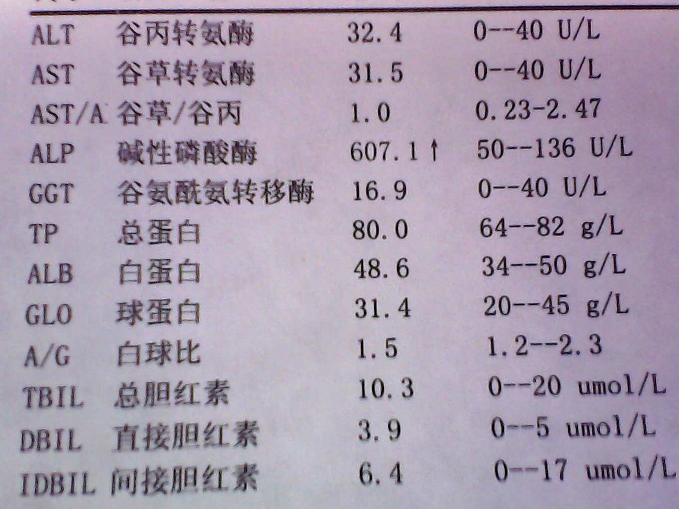 碱性磷酸酶偏高是怎么回事