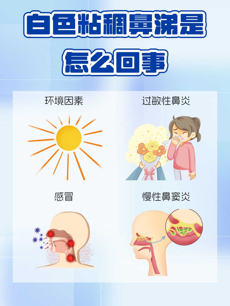 羊舌向