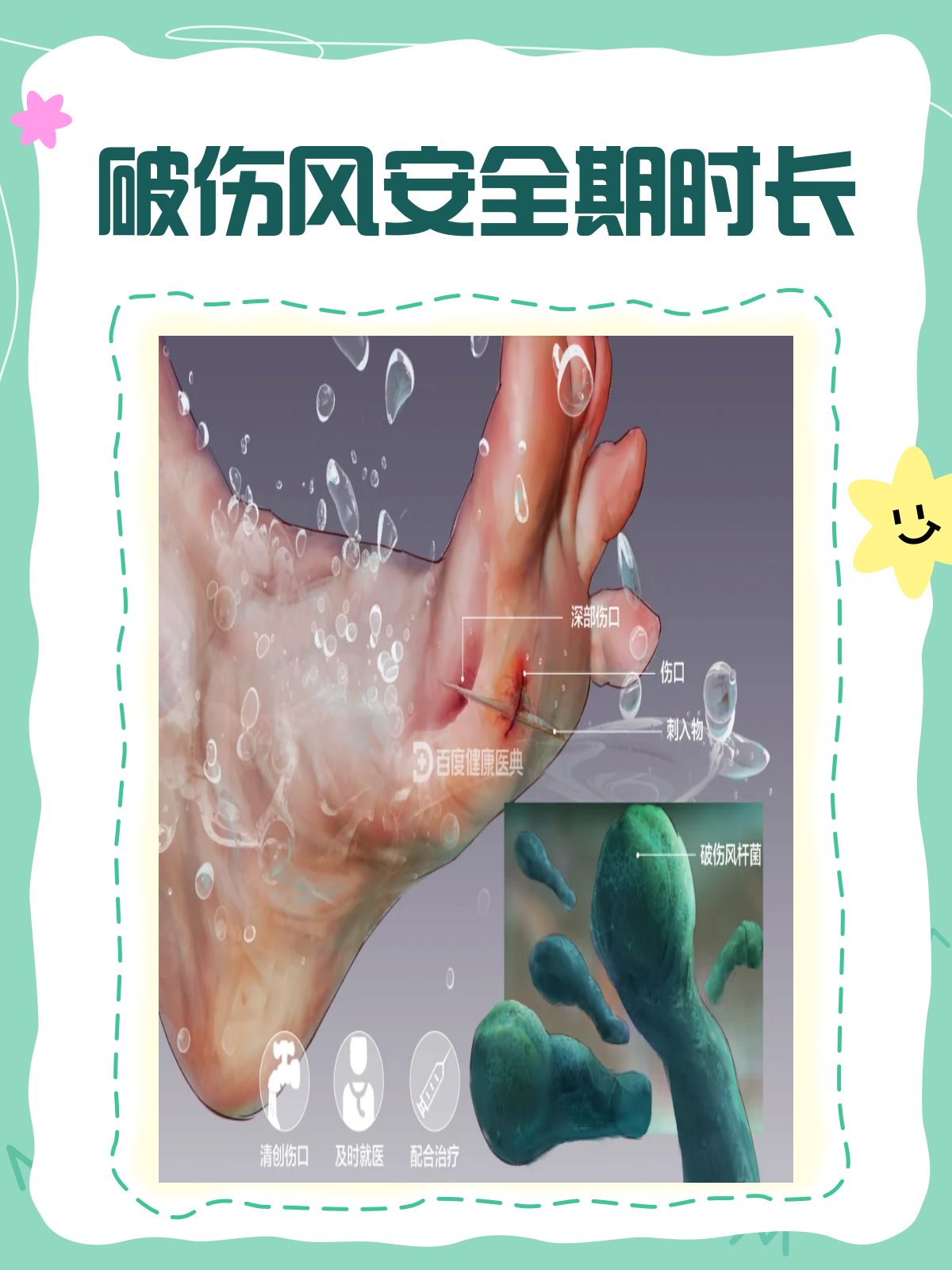 破伤风潜伏期是多久