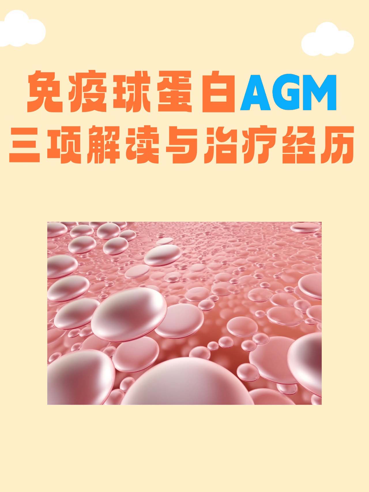 免疫球蛋白G偏高会怎样