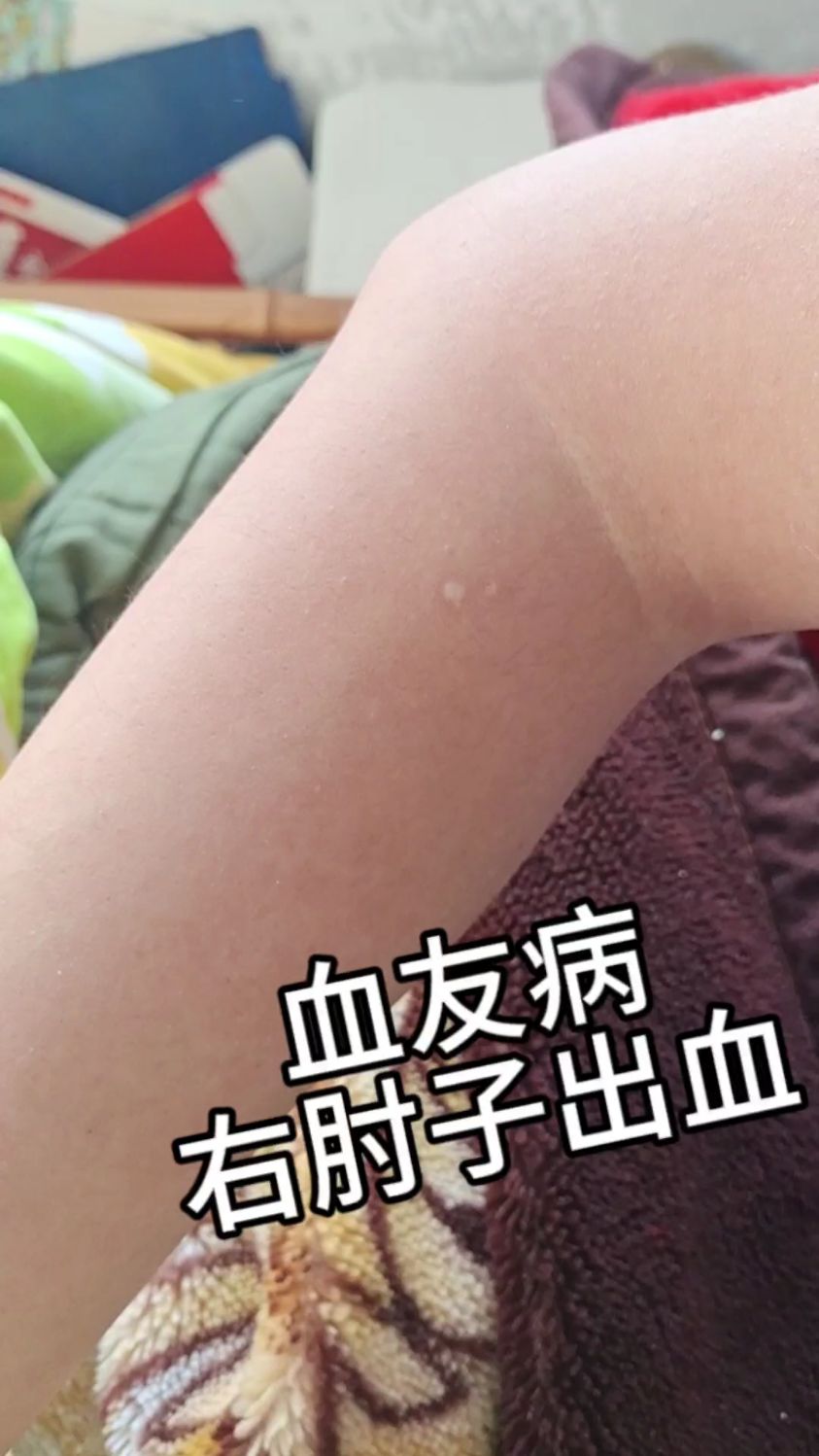 褚茉