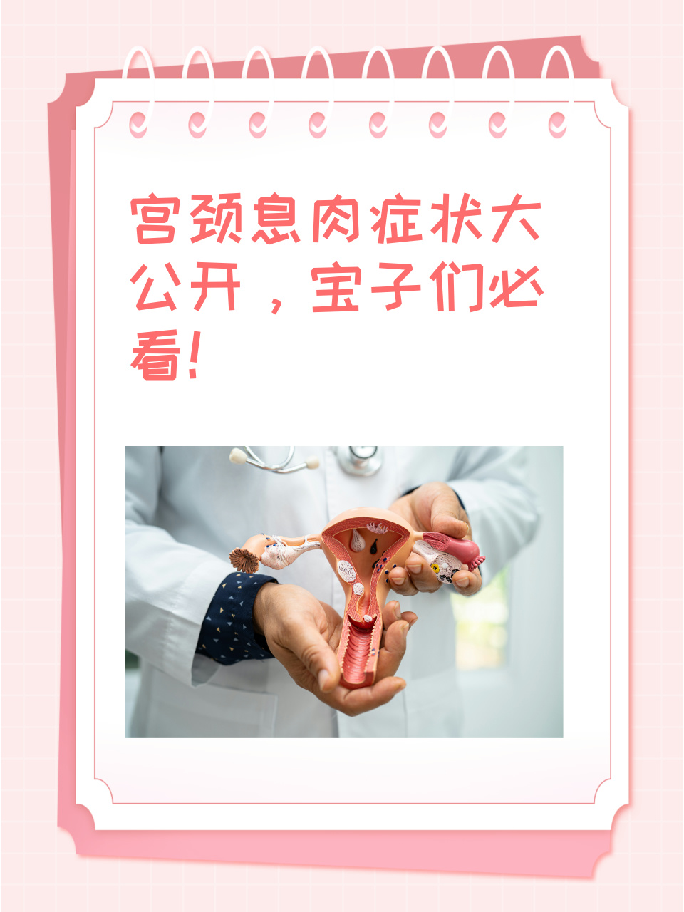 什么是息肉