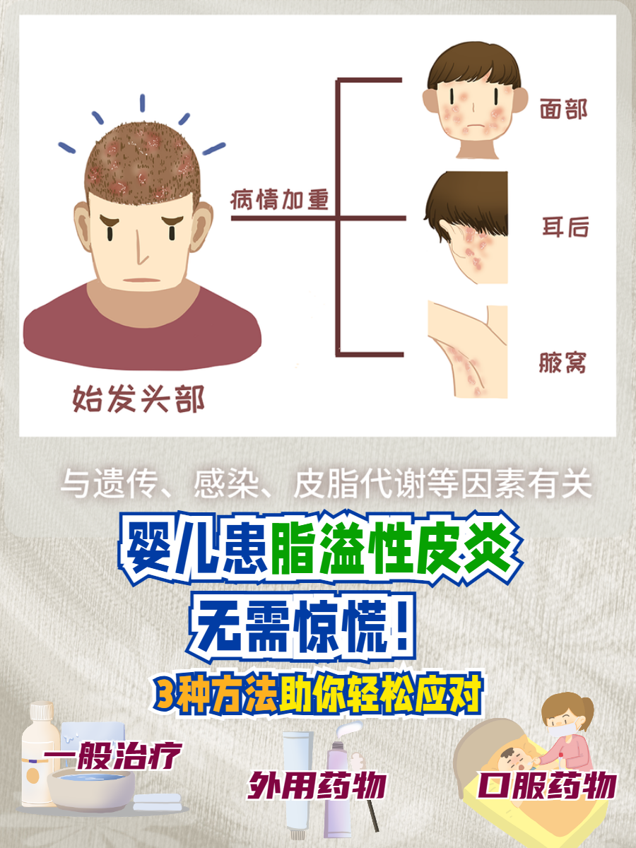 头皮脂溢性皮炎怎么治疗
