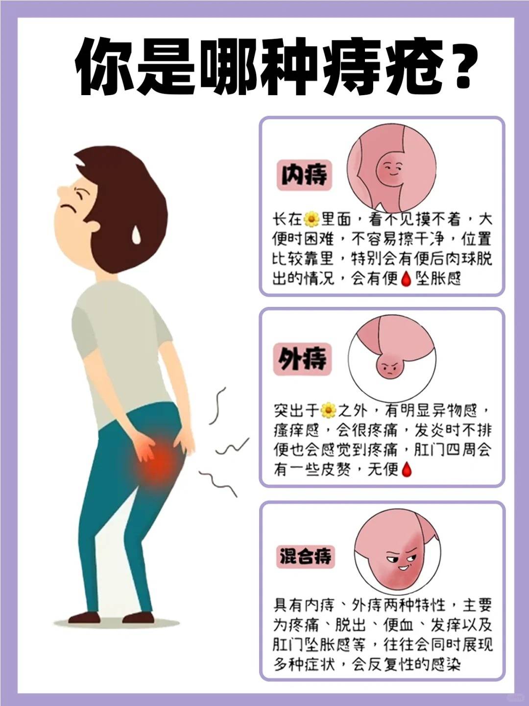 内痔的治疗方法