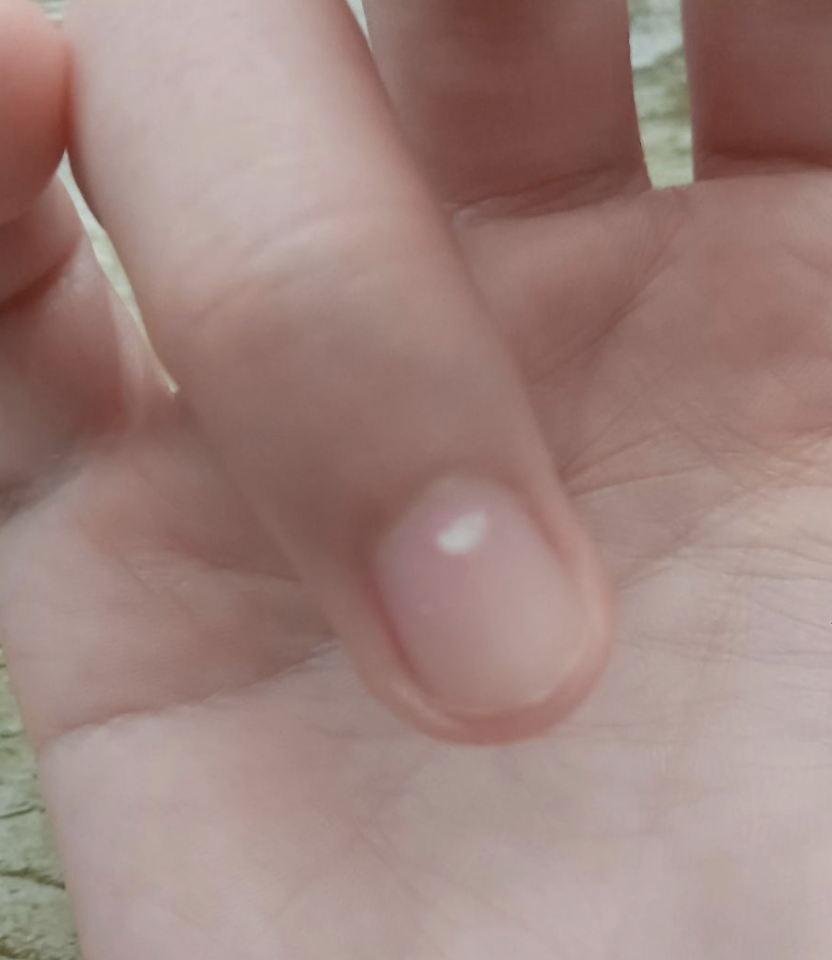 綦秀雅