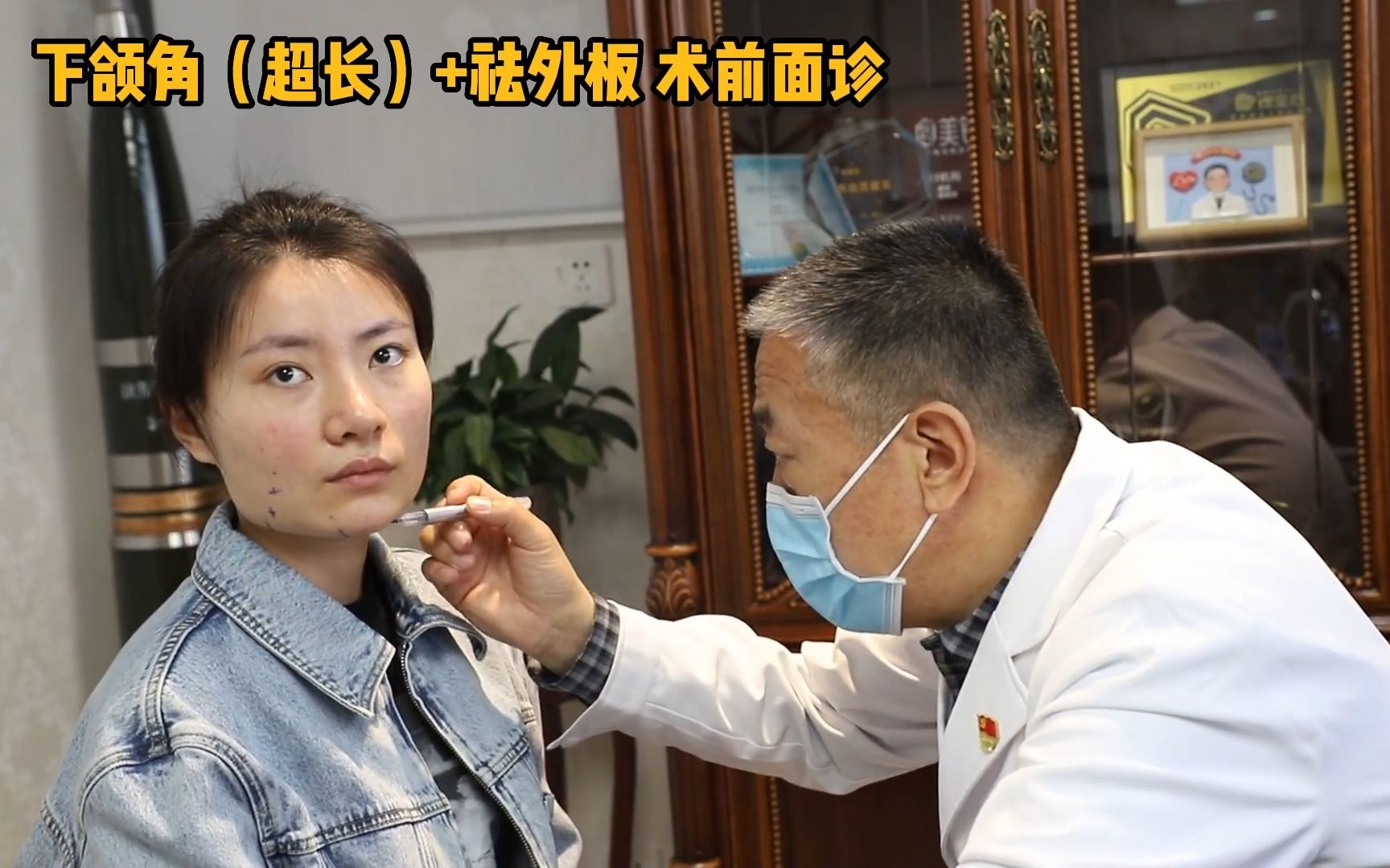下颌角外翻怎么办