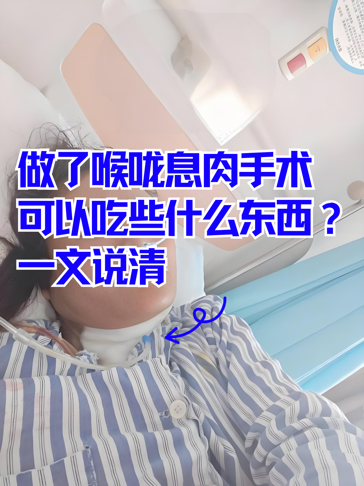 声带息肉有几种手术方法