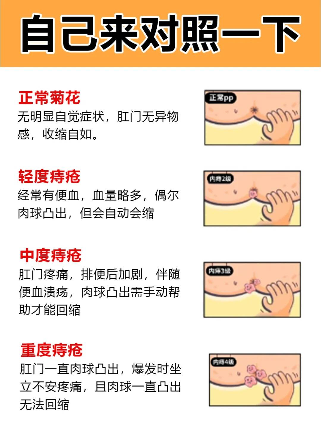 痔疮会传染吗?