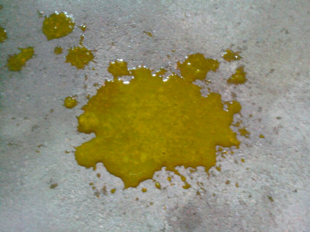 发烧,拉肚子,拉的像水一样