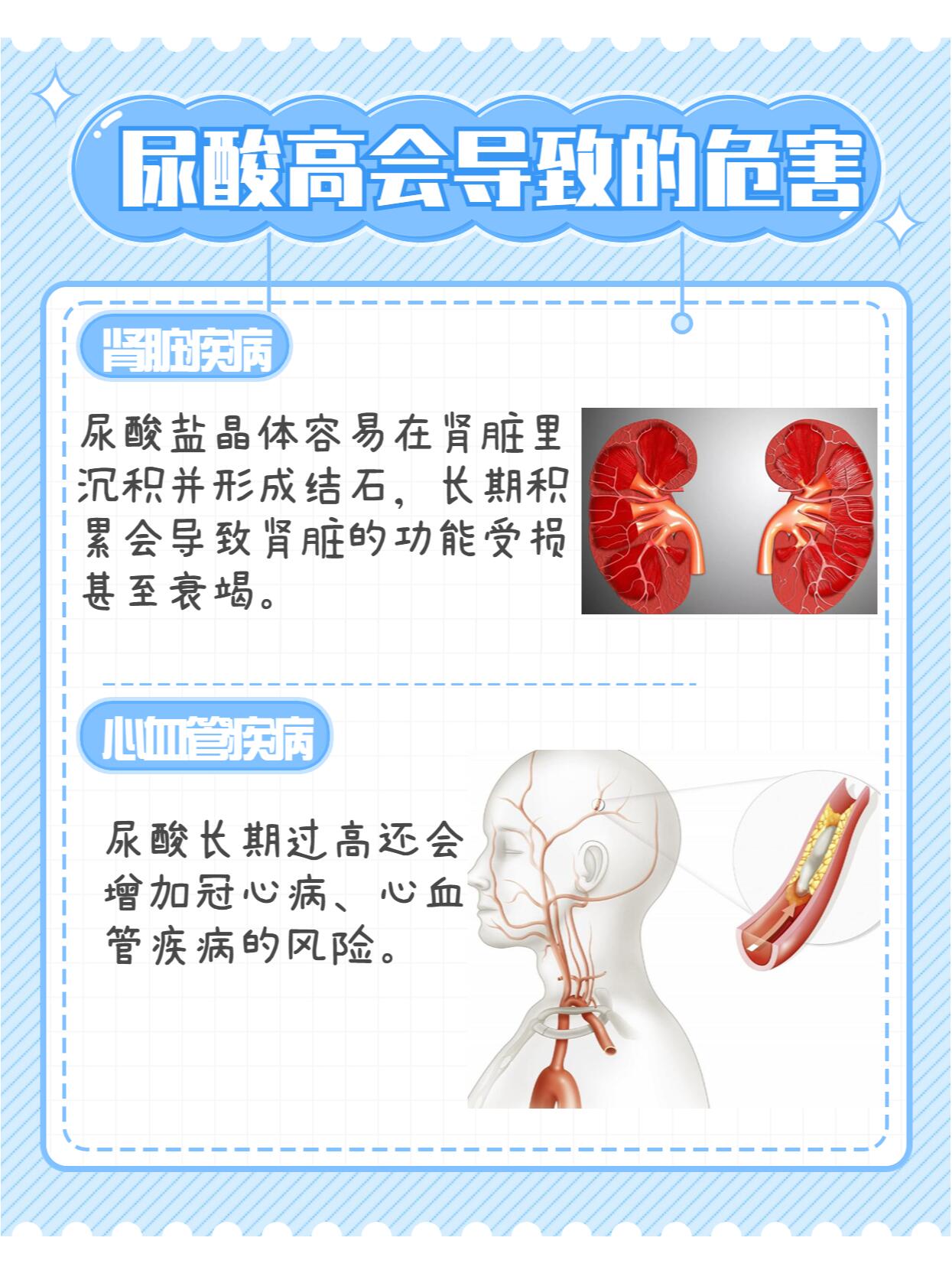 尿酸高是什么原因导致的