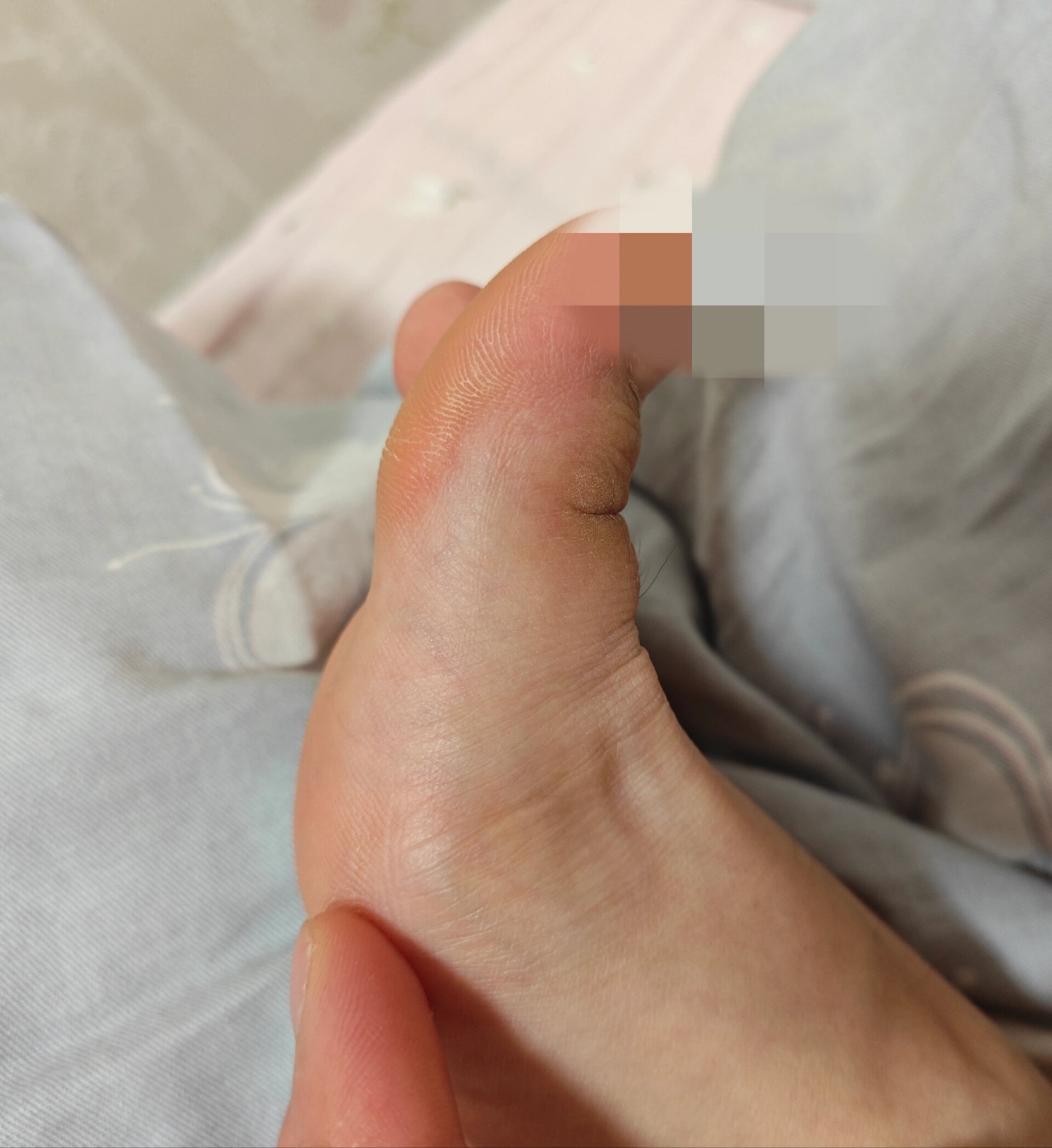 脚大拇指发麻