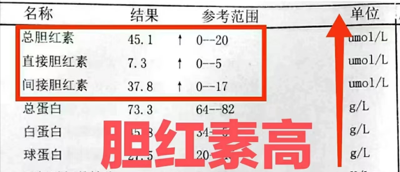 alt正常值