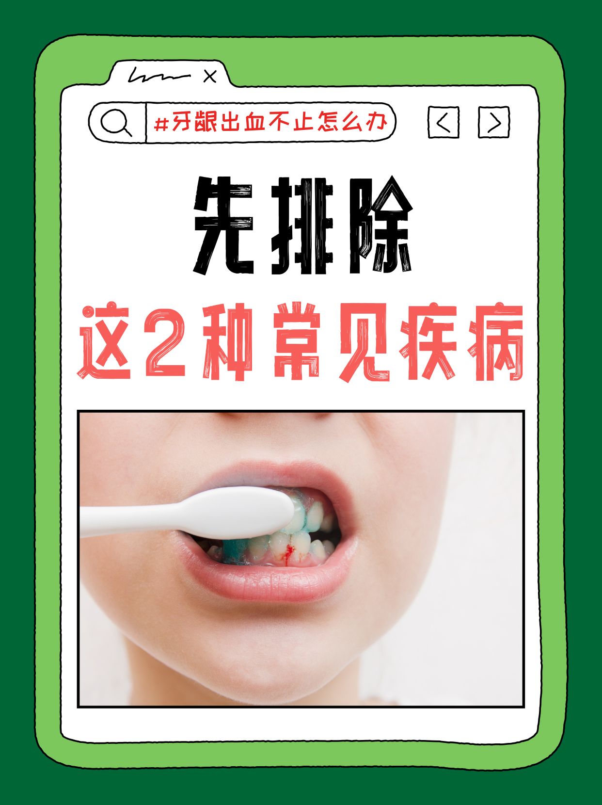 牙龈出血缺什么???