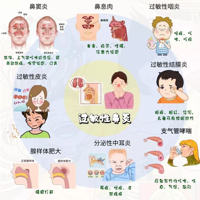 鼻炎的严重性