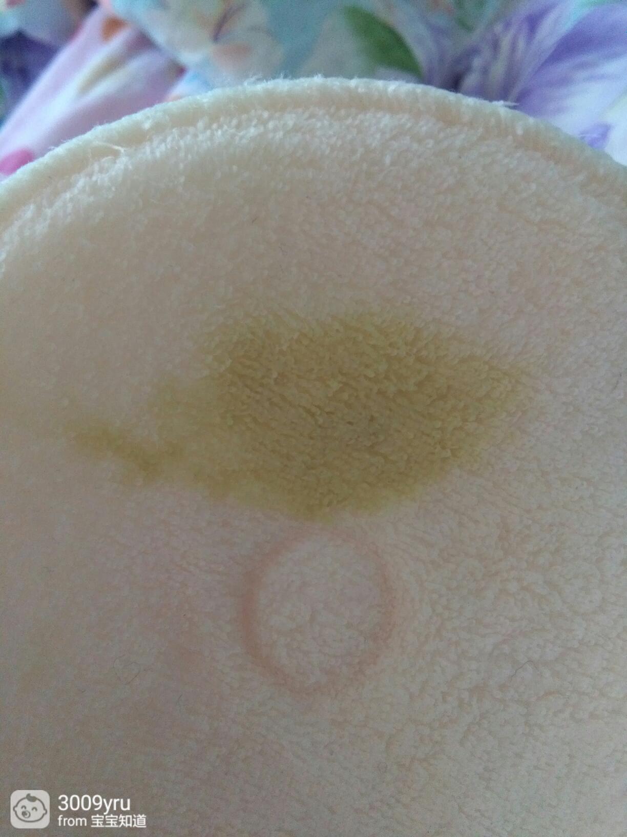 乳头能挤出黄水是怎么回事