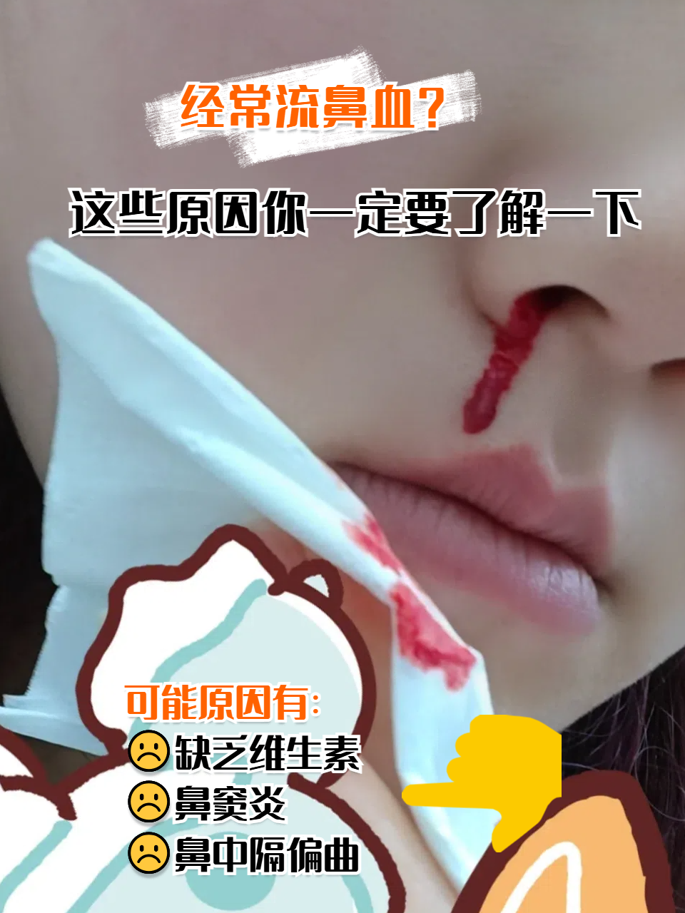 鼻炎会引起流鼻血吗