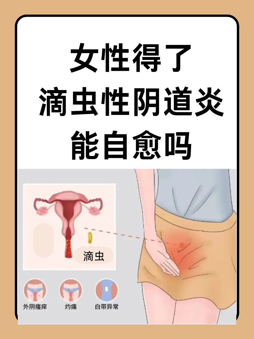 滴虫有哪些症状