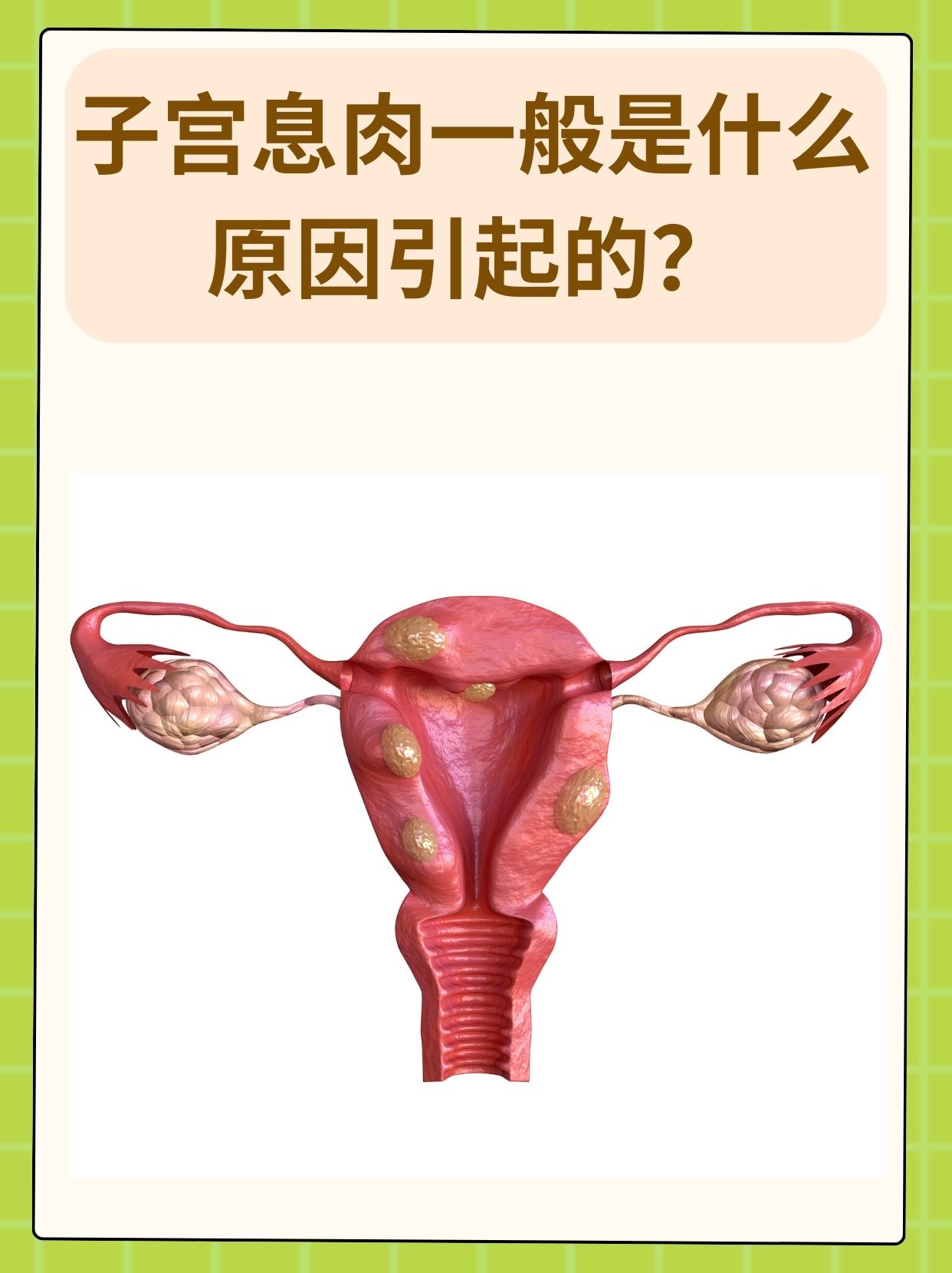 子宫息肉会很严重吗