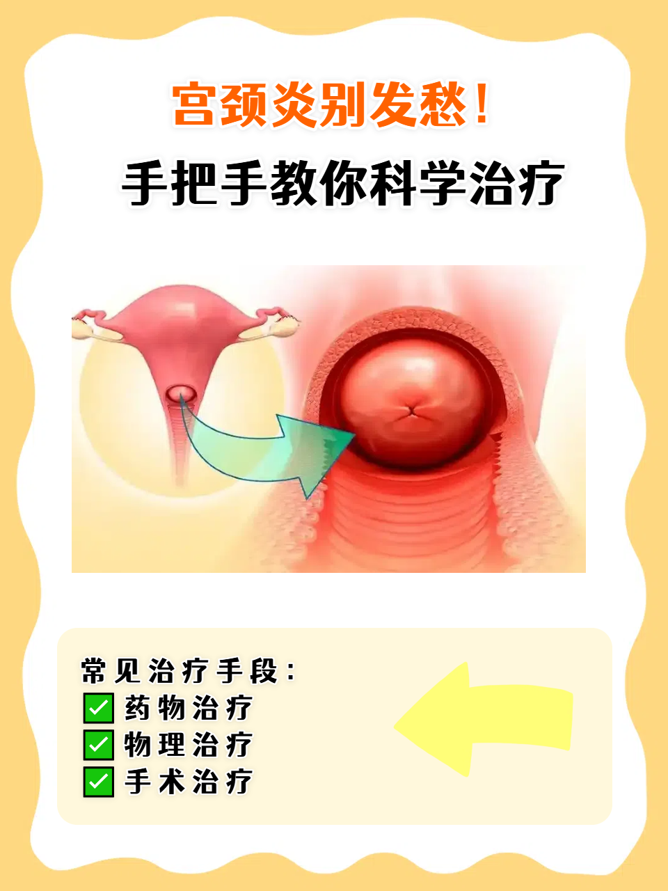 宫颈炎怎么治疗呢?