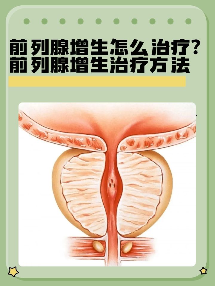男性前列腺的症状有哪些