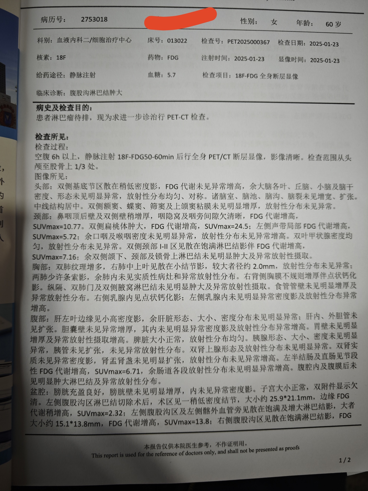 petct多少钱做一次