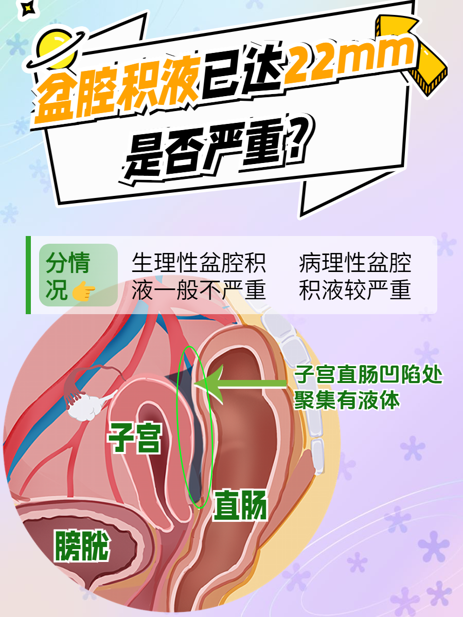 盆腔少许积液正常吗