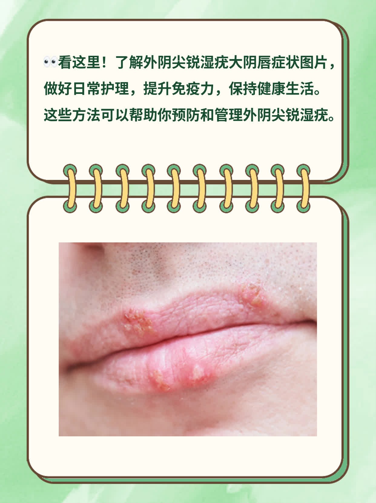 阴道有疙瘩,
