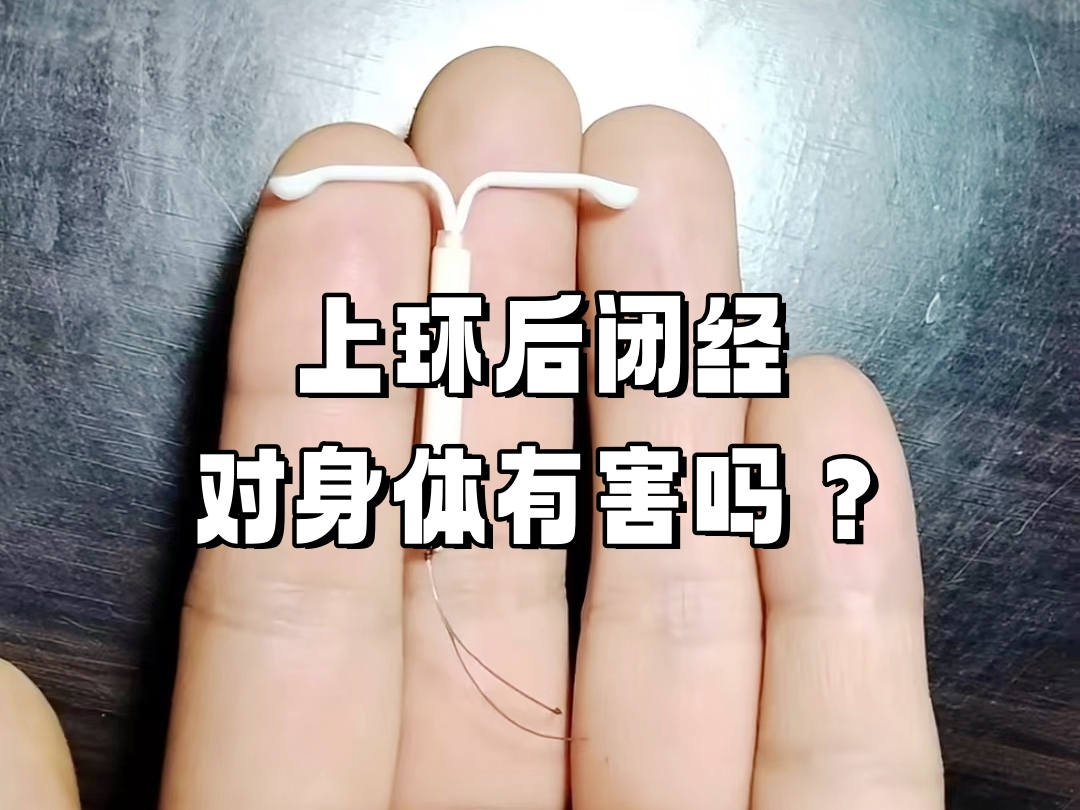 曼月乐的优缺点